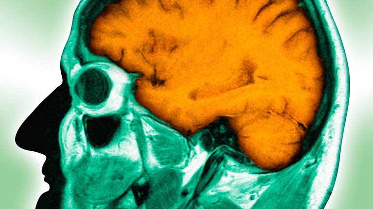 Quarterly-2015_web_neuromyths_2_85757919_1536_Original